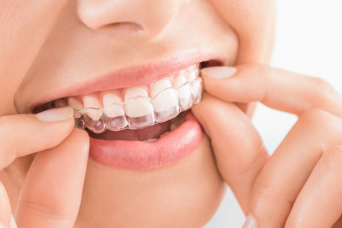 Orthodontist El Paso