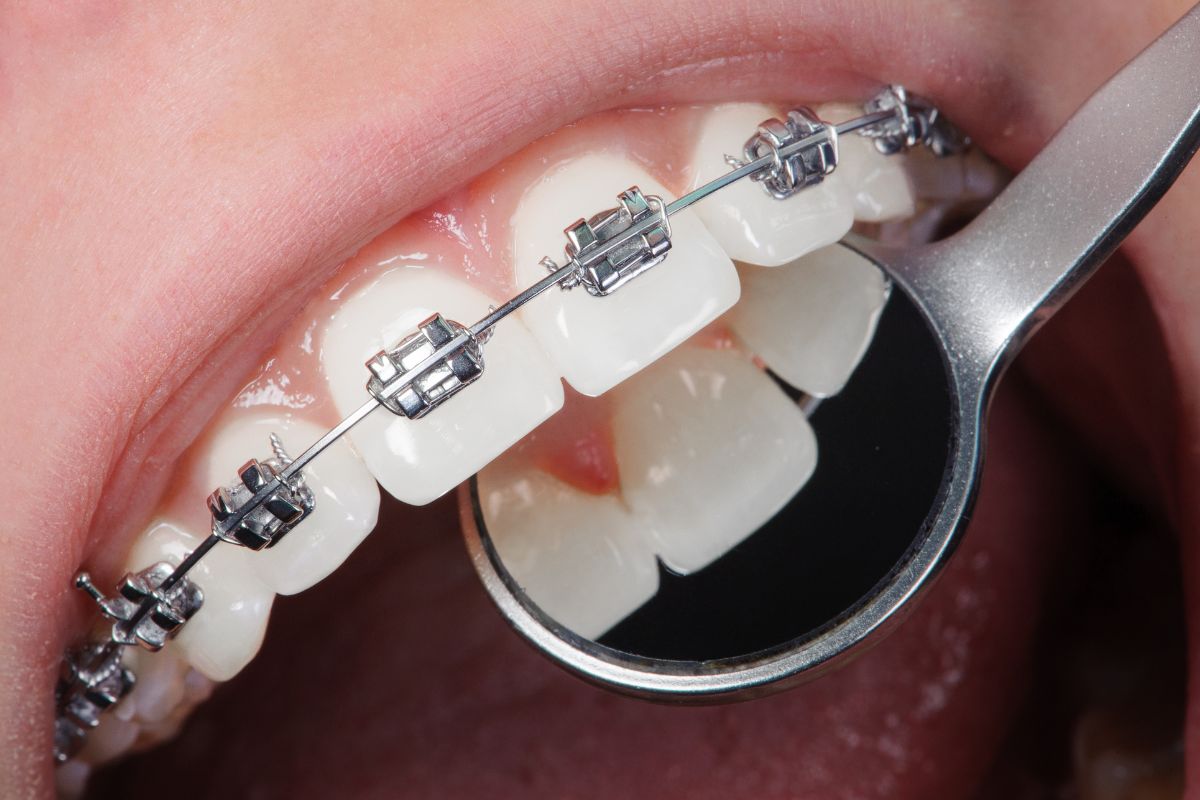 orthodontist in El Paso