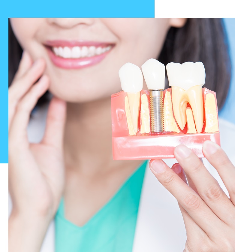 Dental Implants El Paso